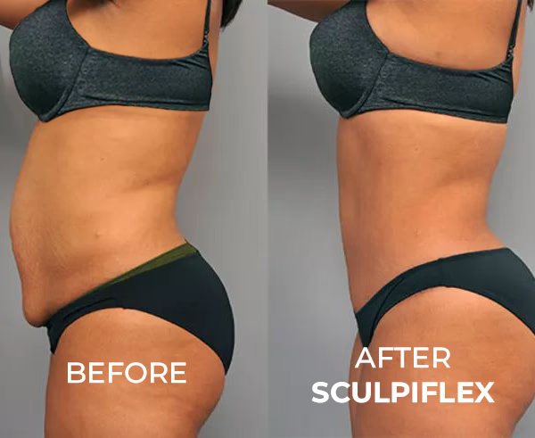 Before and after body transformation