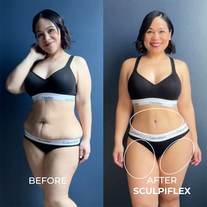 Before and after body transformation